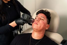 Cosmetic procedure on a man’s face while he reclines in a treatment chair