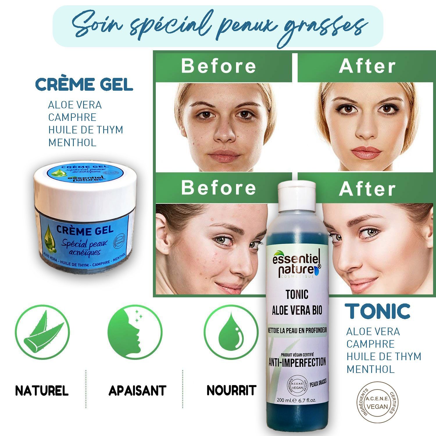 Notre pack comprend : TONIC ALOE VERA PEAUX ACNEÏQUES/GRASSES CREME GEL ALOE VERA SPECIAL PEAUX ACNEIQUES 50ml