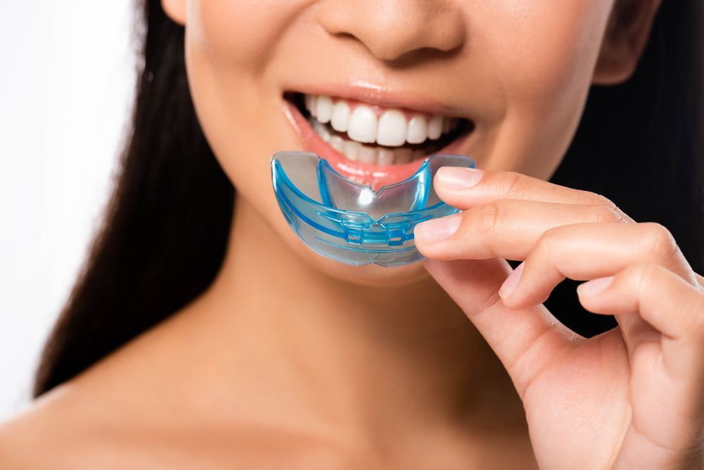 A Person Holds a Blue Dental Mouthguard Up to Their Smiling Mouth — Mareeba Dental Centre in Mareeba, QLD