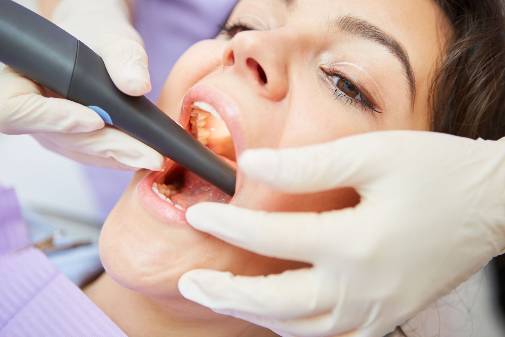East Alton, IL | Root Canal Therapy Treatments