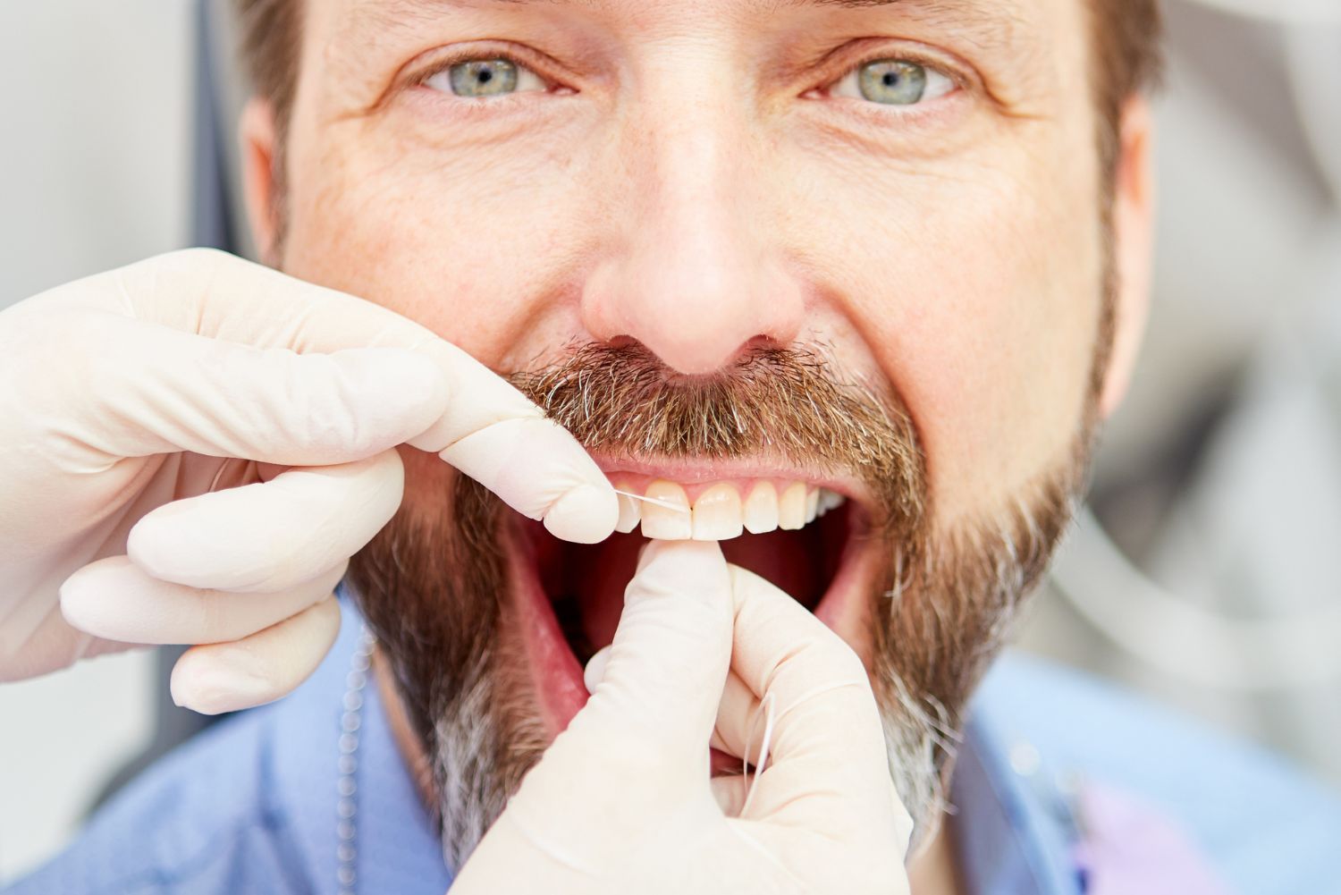 Periodontal Disease Treatment
