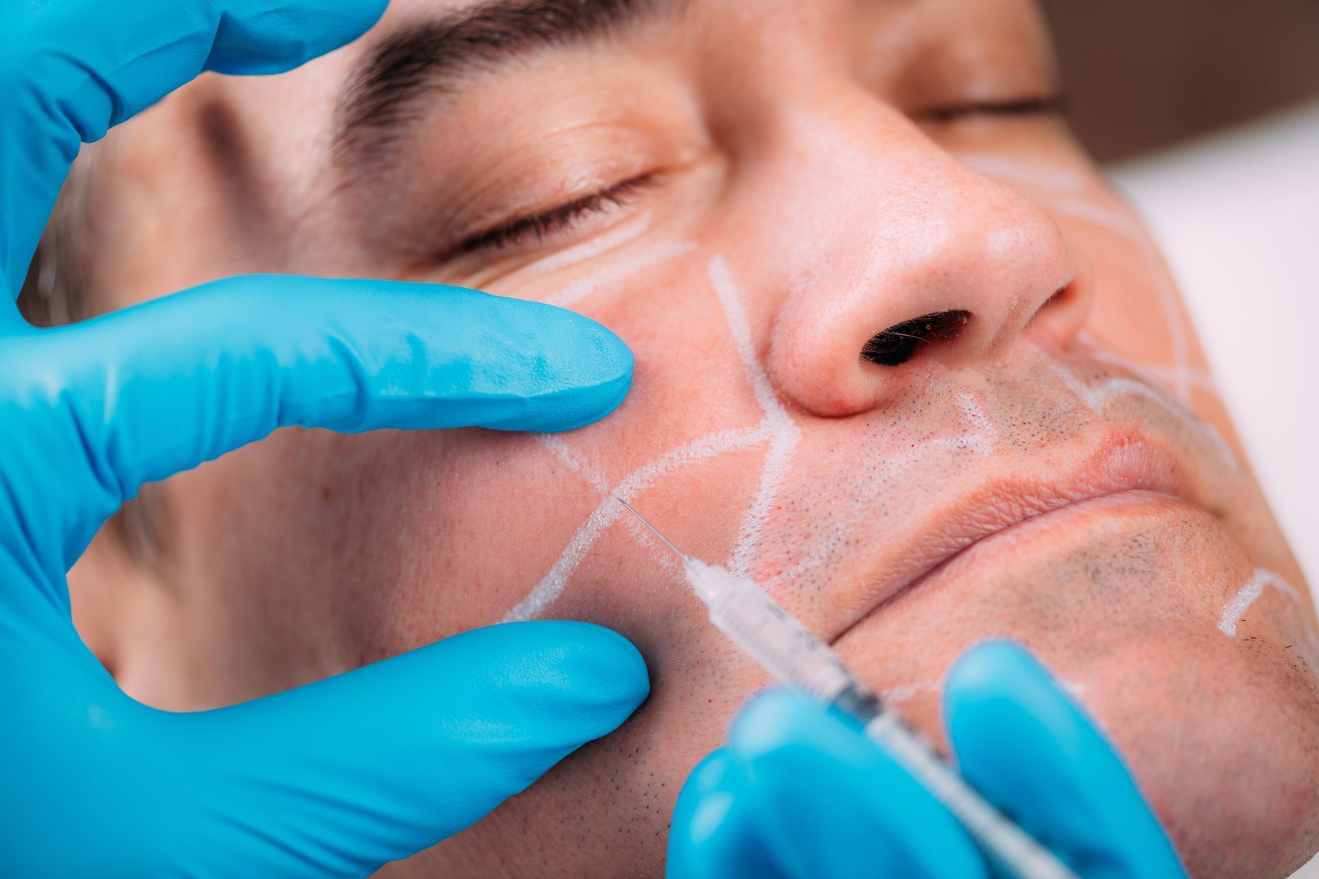 Juvéderm services and treatment in east alton, il