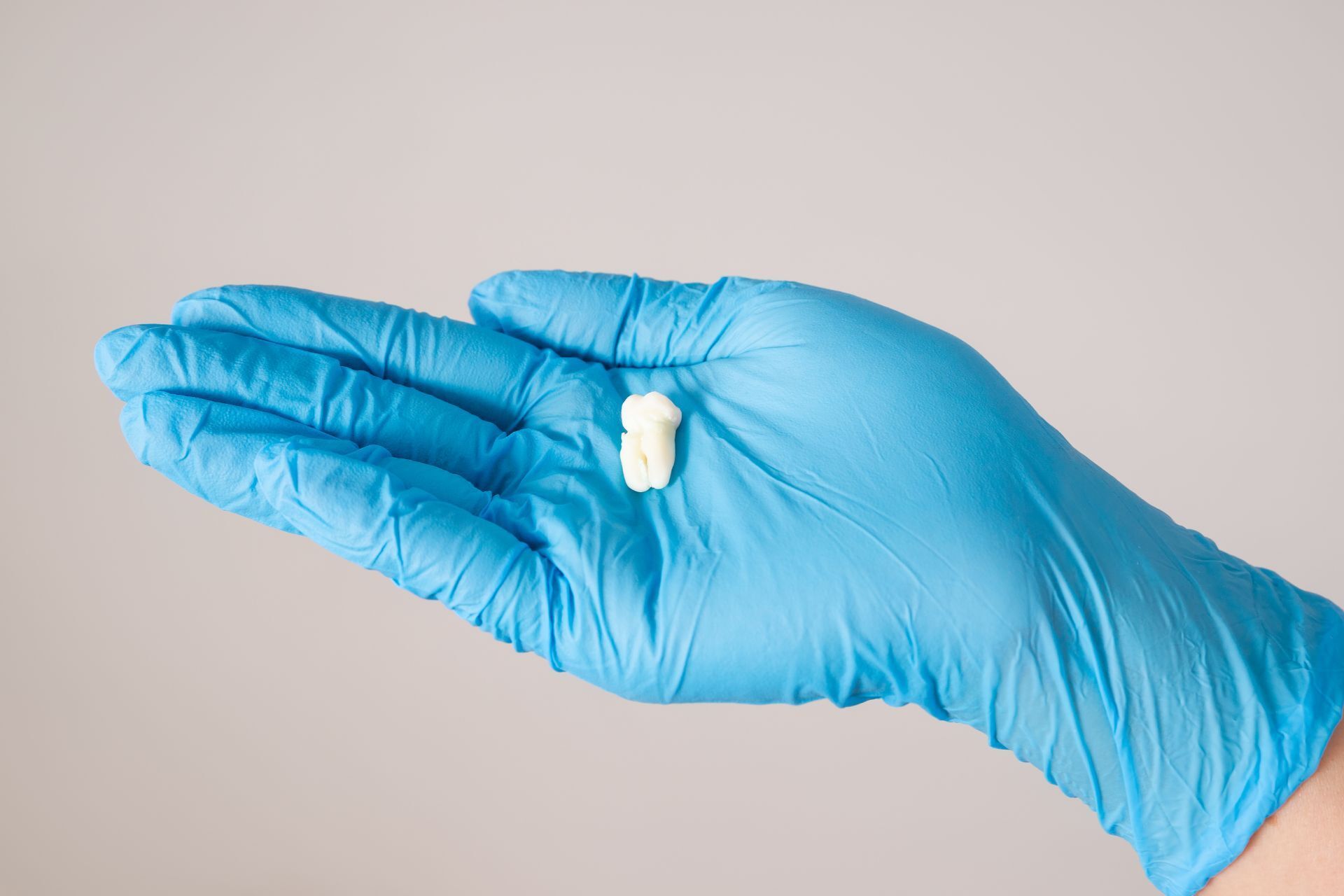 Get Your Wisdom Teeth Removed | East Alton, IL