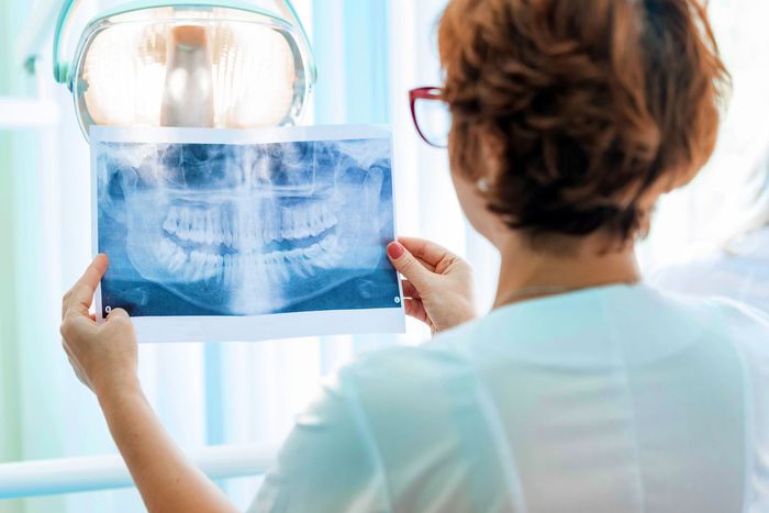 A dentist is looking at an x-ray of a patient 's teeth.