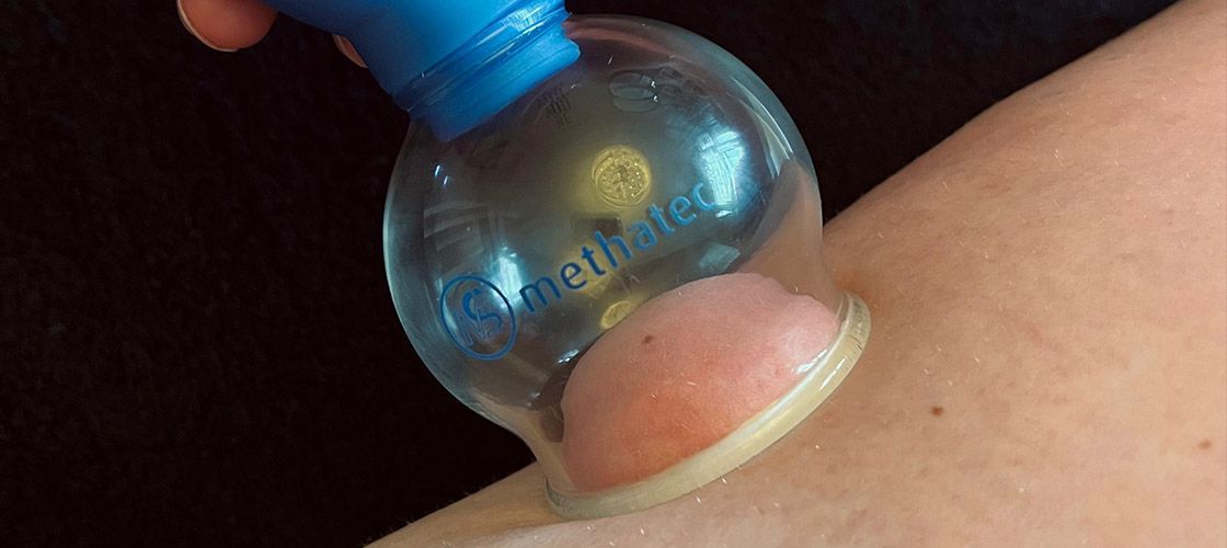 Cellulite