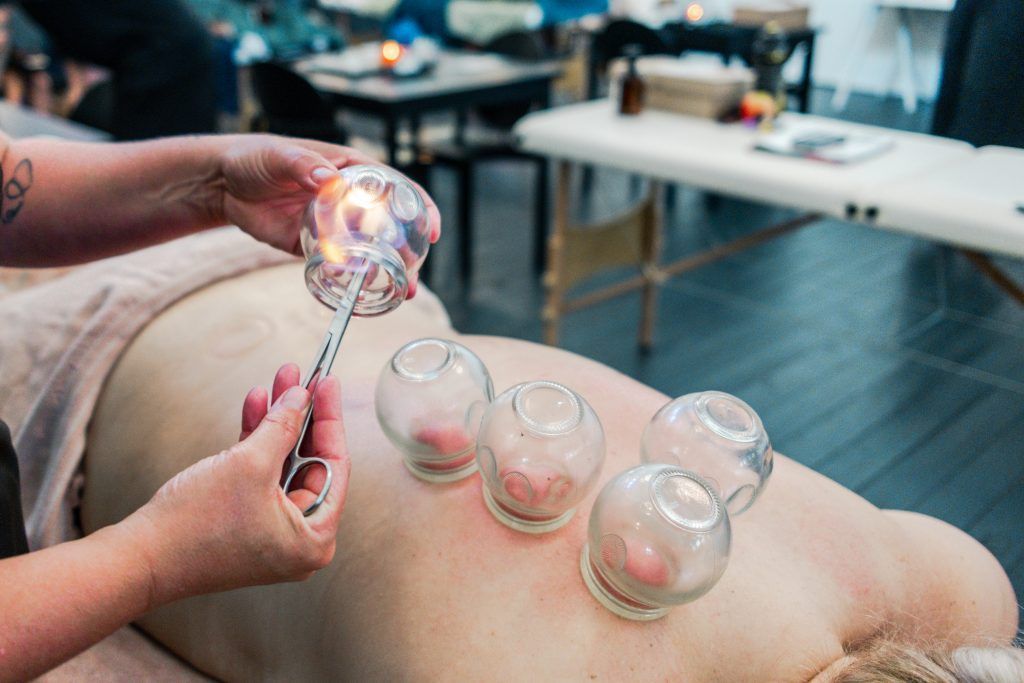 Vuurcupping