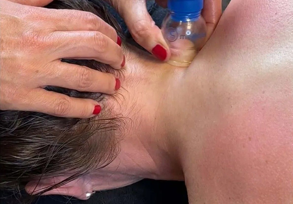 ontspanning cupping