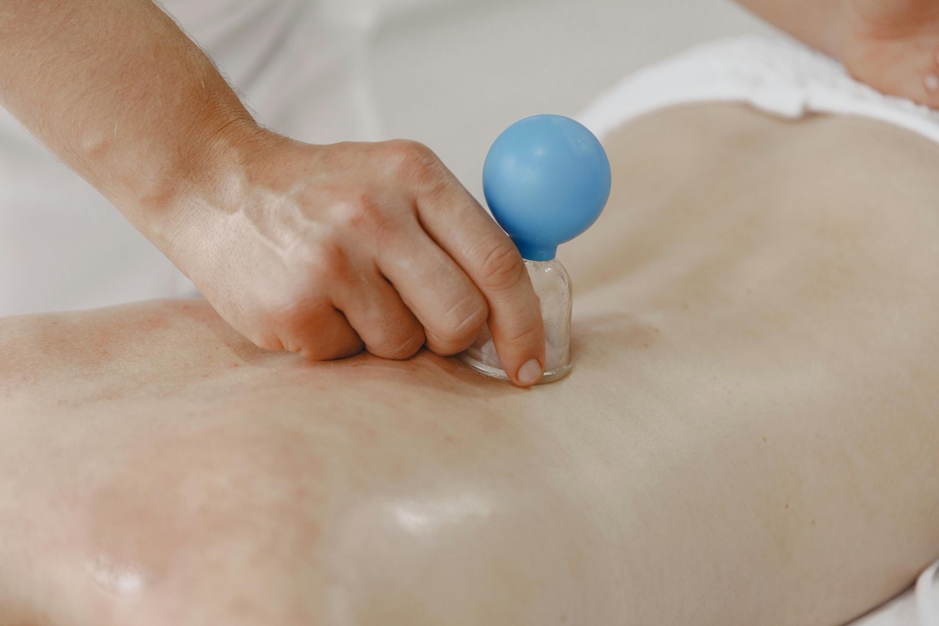 TRANSFORMATIONAL CUPPING®