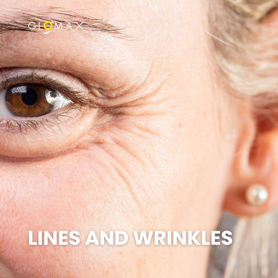 Book your first trial for Anti-aging treatment in Singapore at Glomax Aesthetics for only $99.