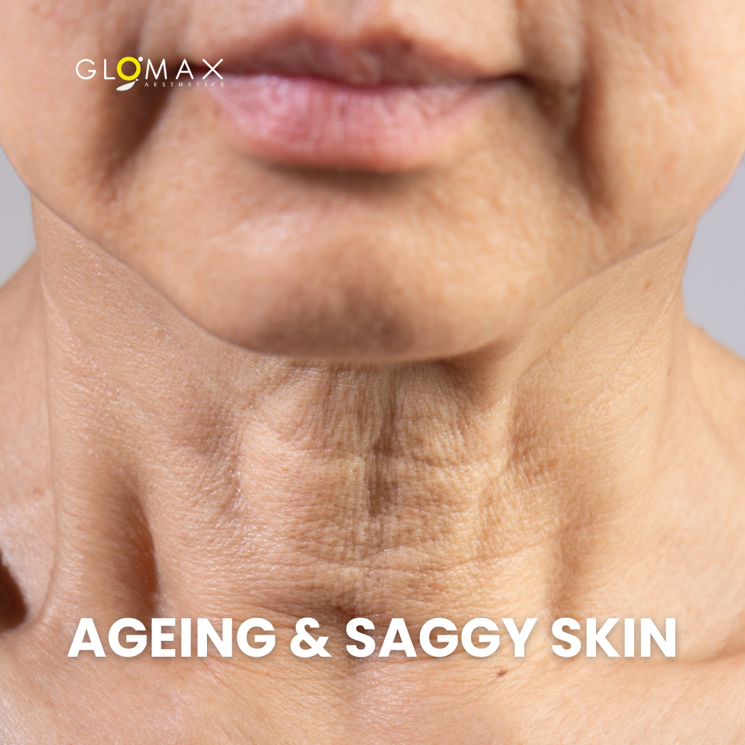Book your first trial for Anti-aging treatment in Singapore at Glomax Aesthetics for only $99.