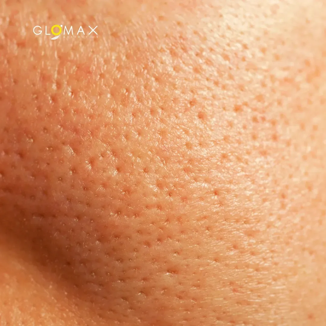 Skin Rejuvenation