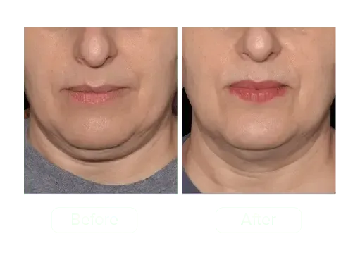 GLO-Sculpt: The 20-Minute