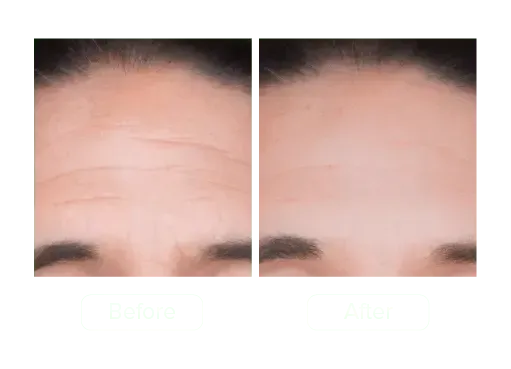 GLO-Sculpt: The 20-Minute