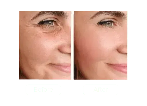 GLO-Sculpt: The 20-Minute