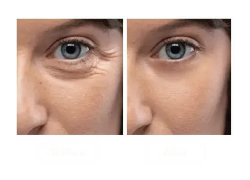 GLO-Sculpt: The 20-Minute