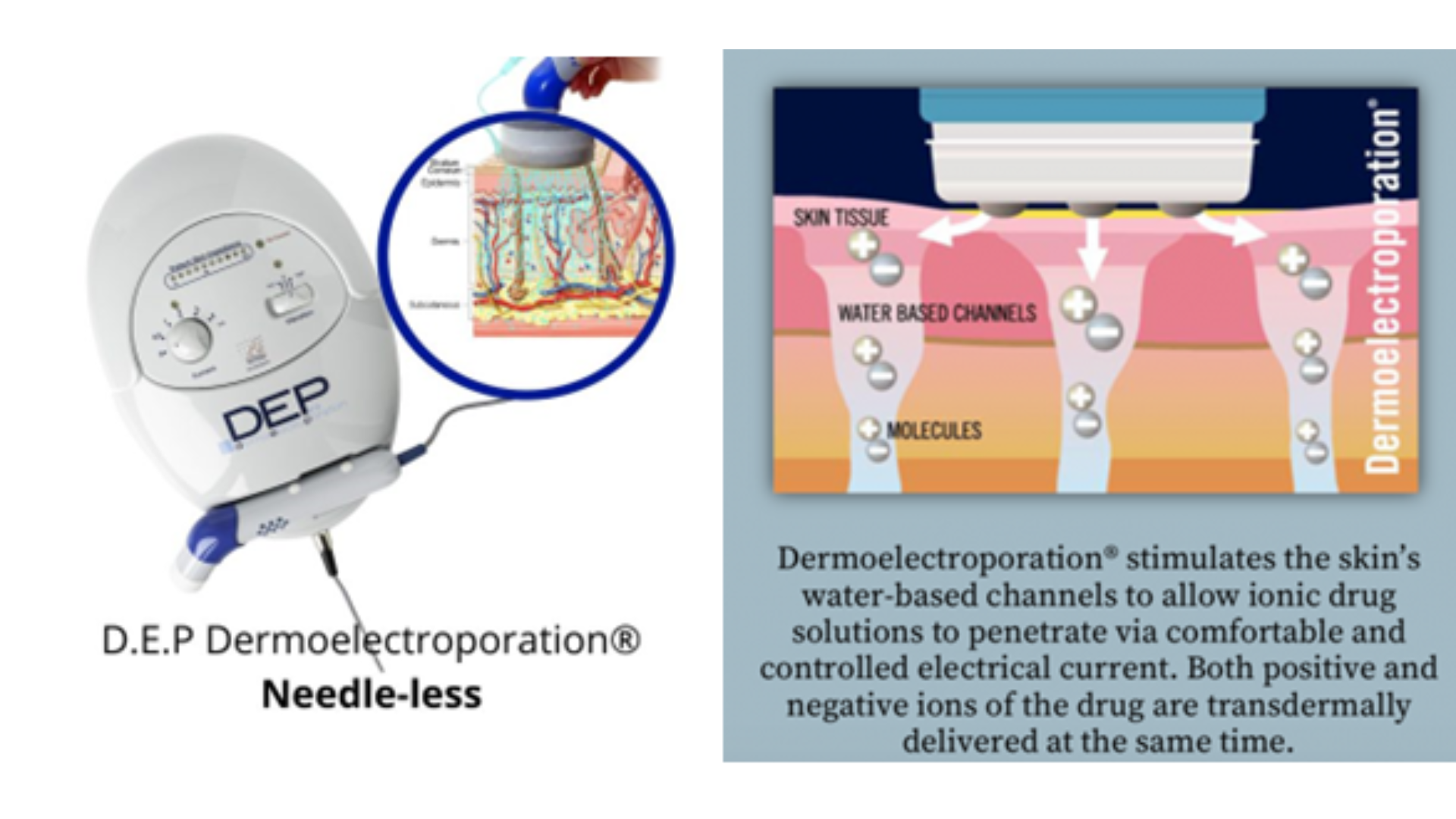 Glomax Aesthetics - DEP Needleless Skin Booster Facial Treatment