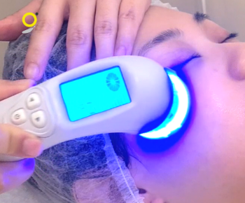 Book your first trial for acne facial treatment in Singapore at Glomax Aesthetics for only $89.