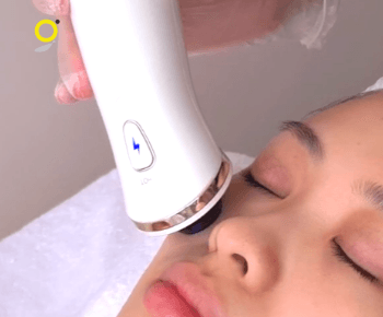 Glomax Aesthetic_Acne Plasma Shower