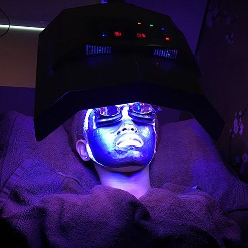 Glomax Aesthetics - Best Anti-Acne Facial in Singapore