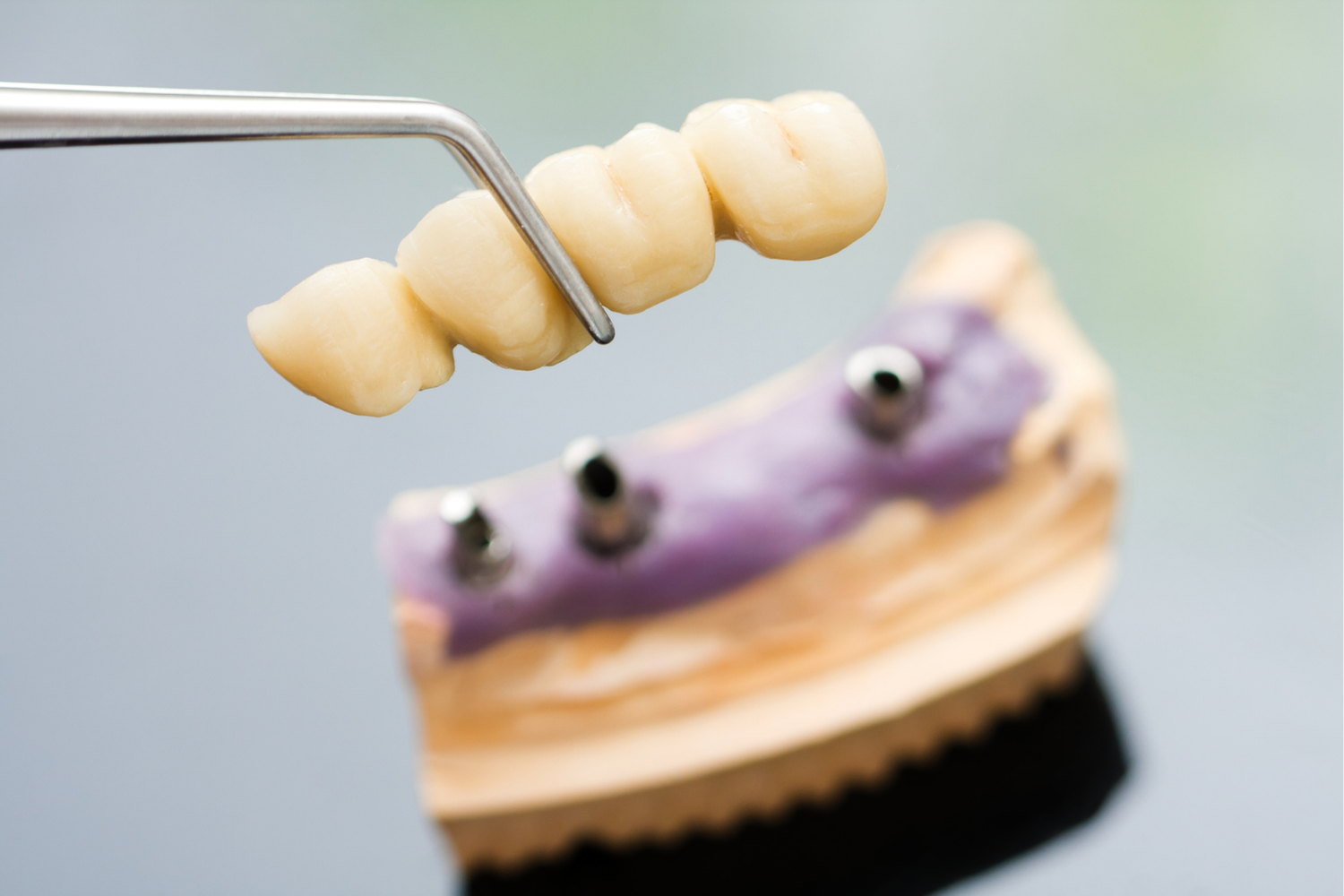 A woman is sitting in a dental chair while a dentist examines her teeth.