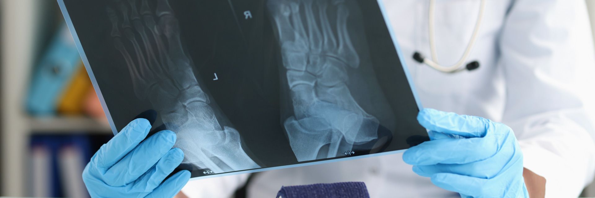 A doctor holding a foot X-ray, wearing blue gloves and a white coat in a medical setting.