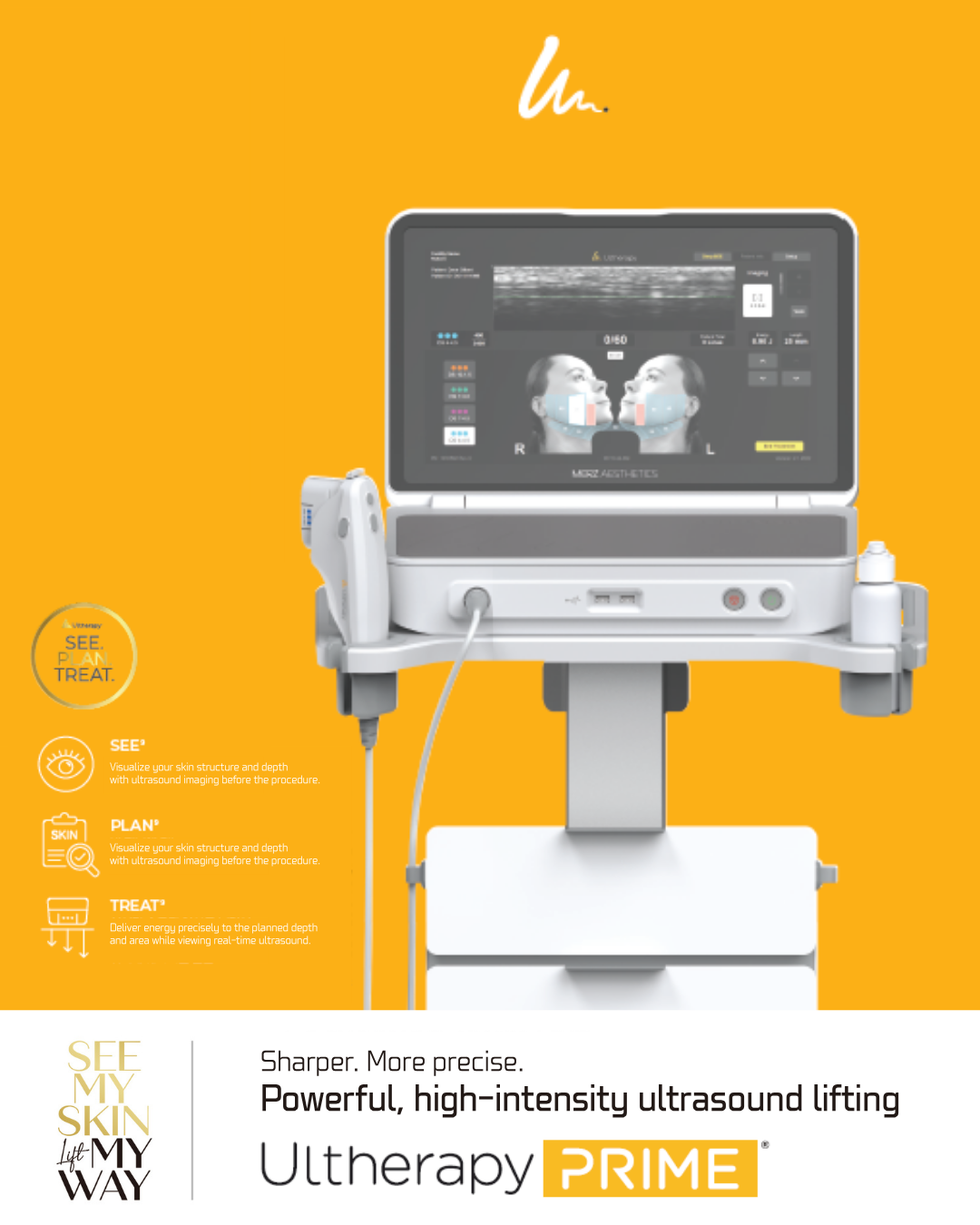Ultherapy Prime treatment details