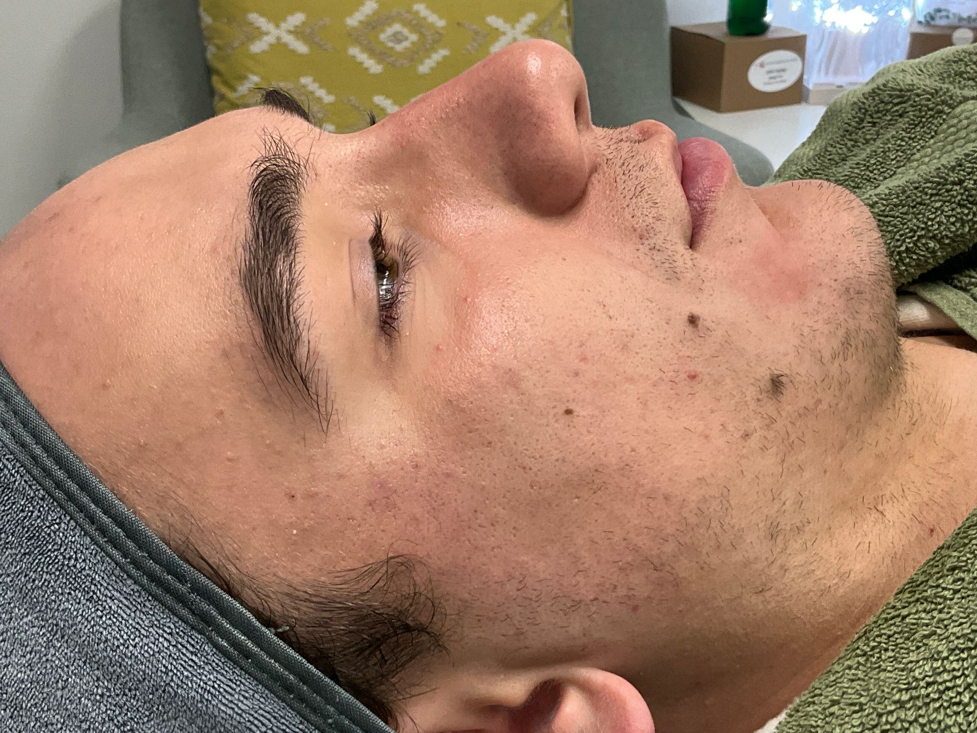 Man lying down, eyes closed, likely receiving facial treatment. Light skin, dark eyebrows, towel.