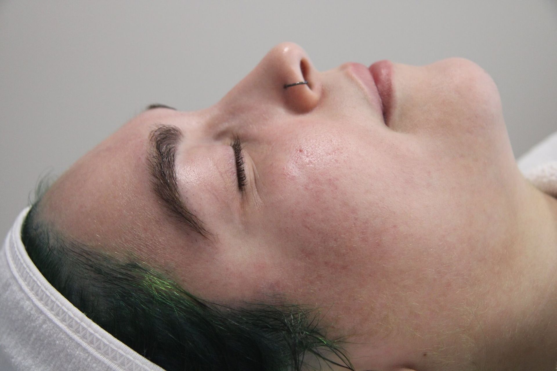 Woman's face in profile, eyes closed, during a skincare treatment. Pinkish skin, close-up.