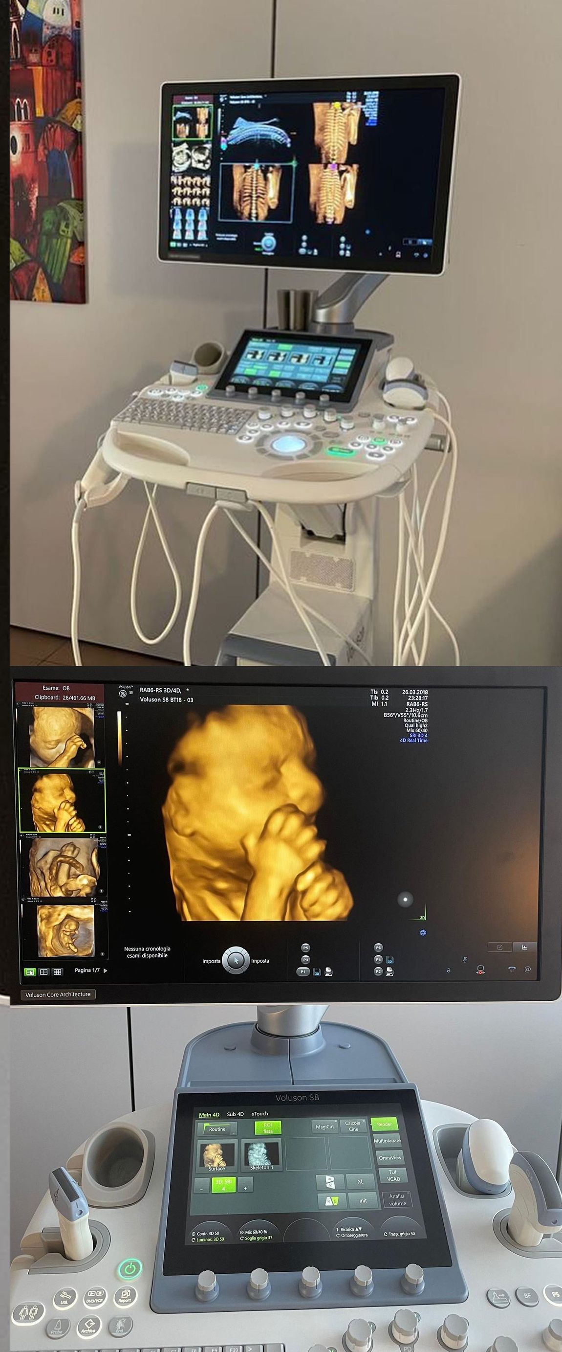 trattamento di tecar terapia