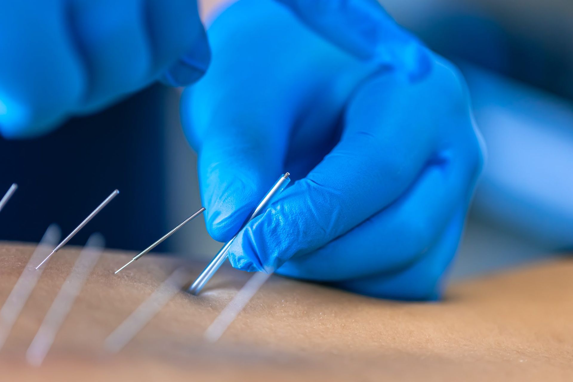 OZONOTERAPIA E TERAPIA DEL DOLORE