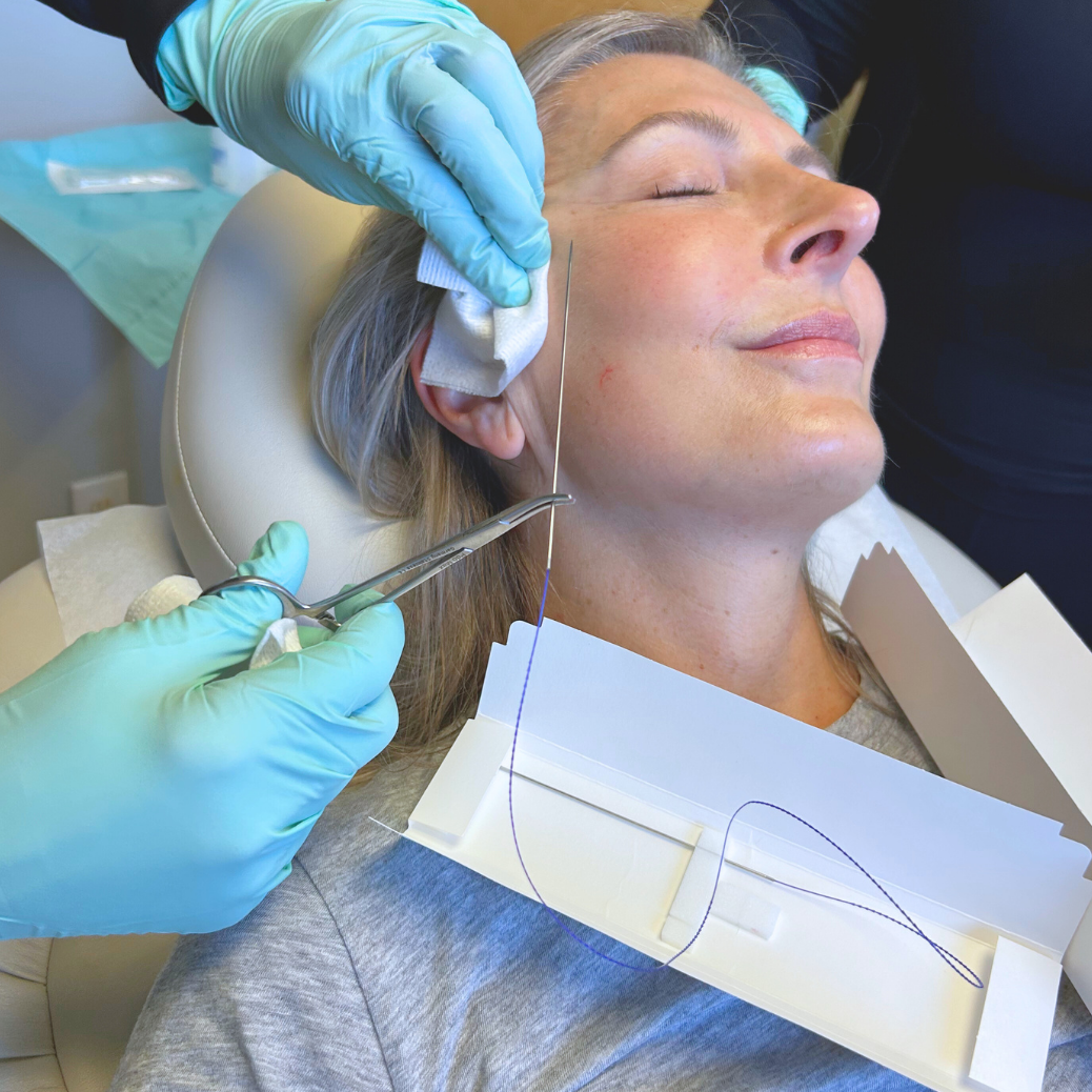Cosmetic procedure in progress on a patient reclining in a clinic, with gloved hands and gauze near the ear