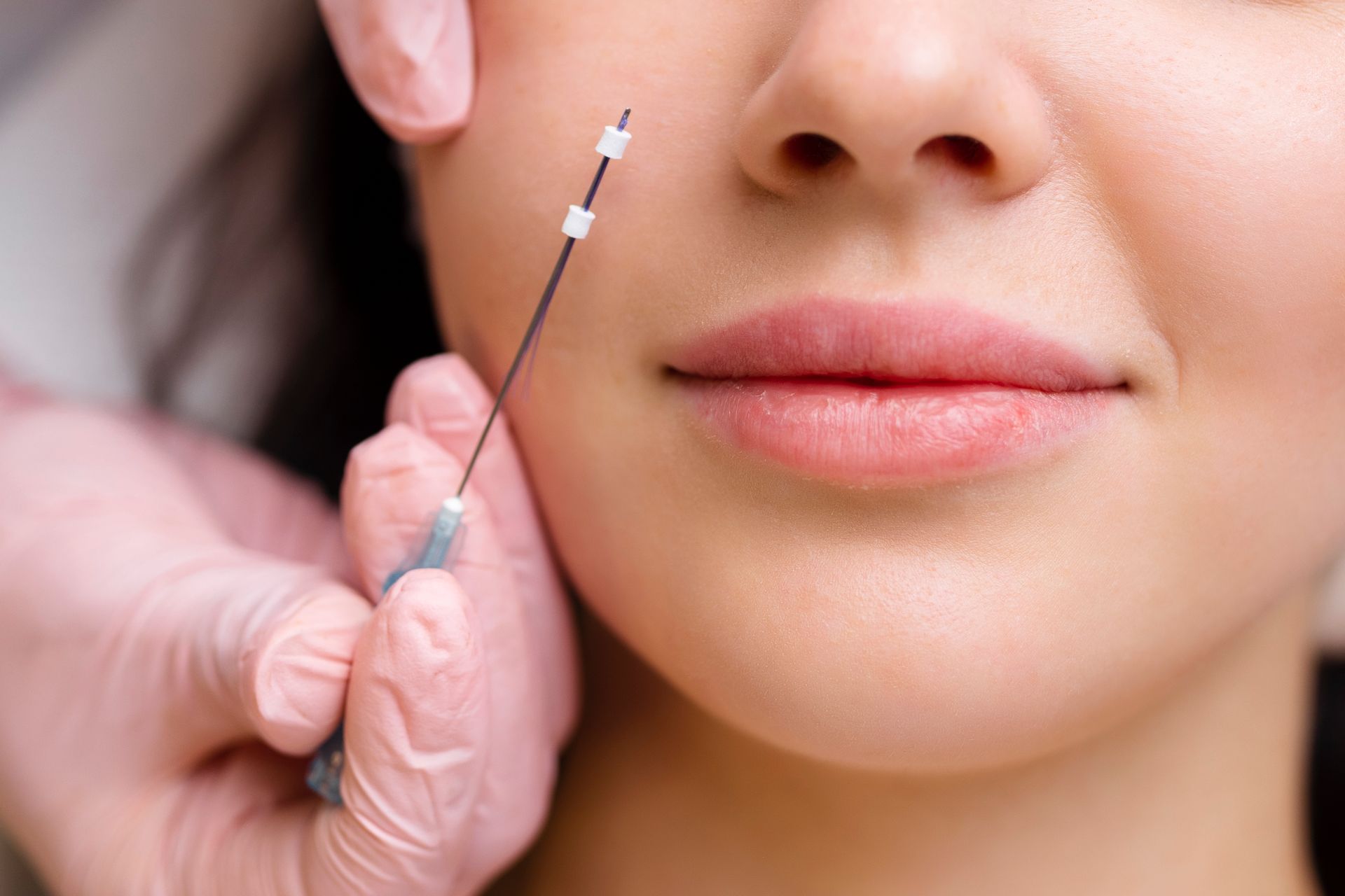 collagen threads wesley chapel florida
