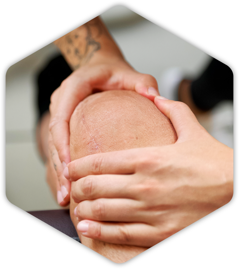 Eine Person bekommt eine Narbenmassage am Knie