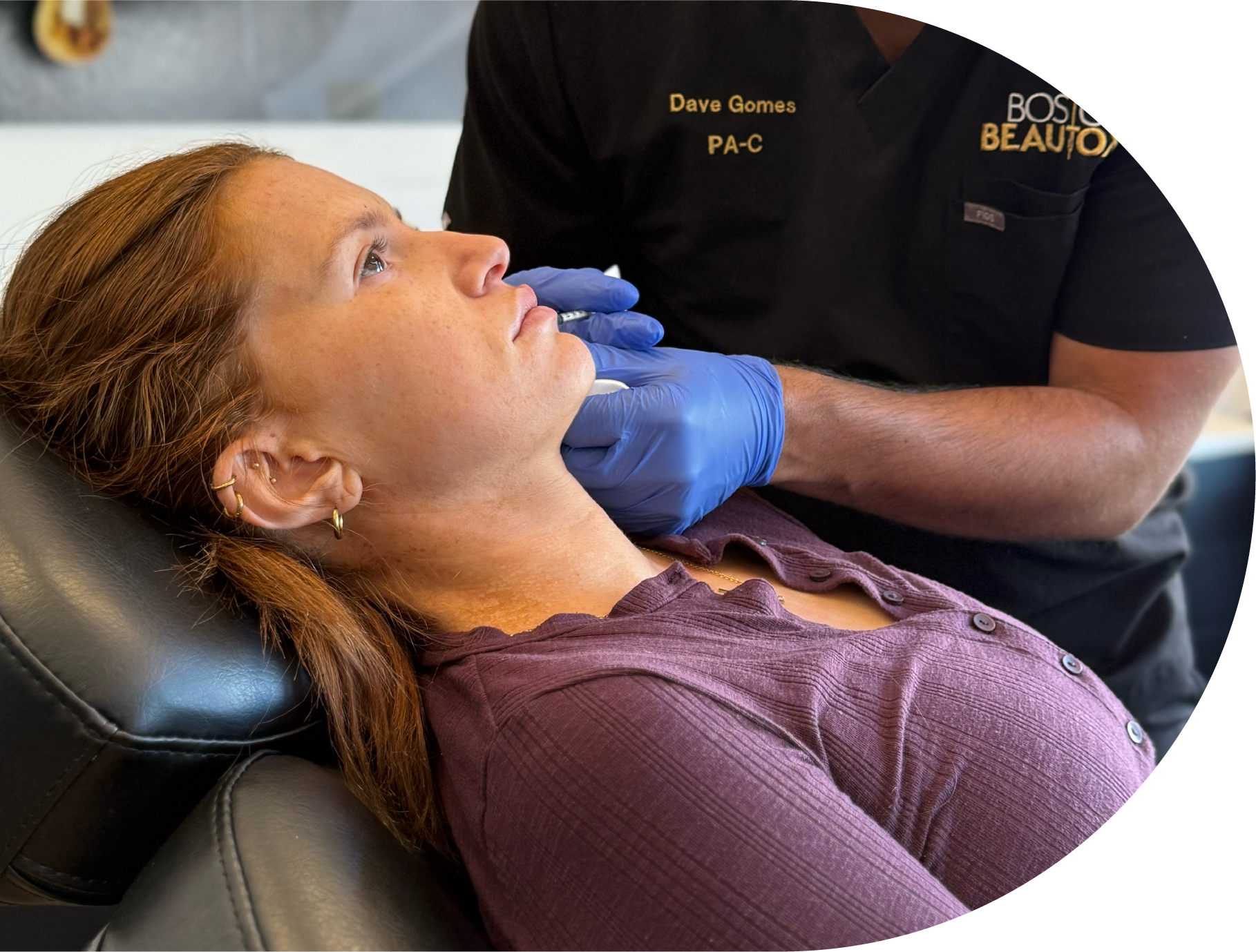 Patient receiving dermal filler injection at Boston Beautox in South Boston