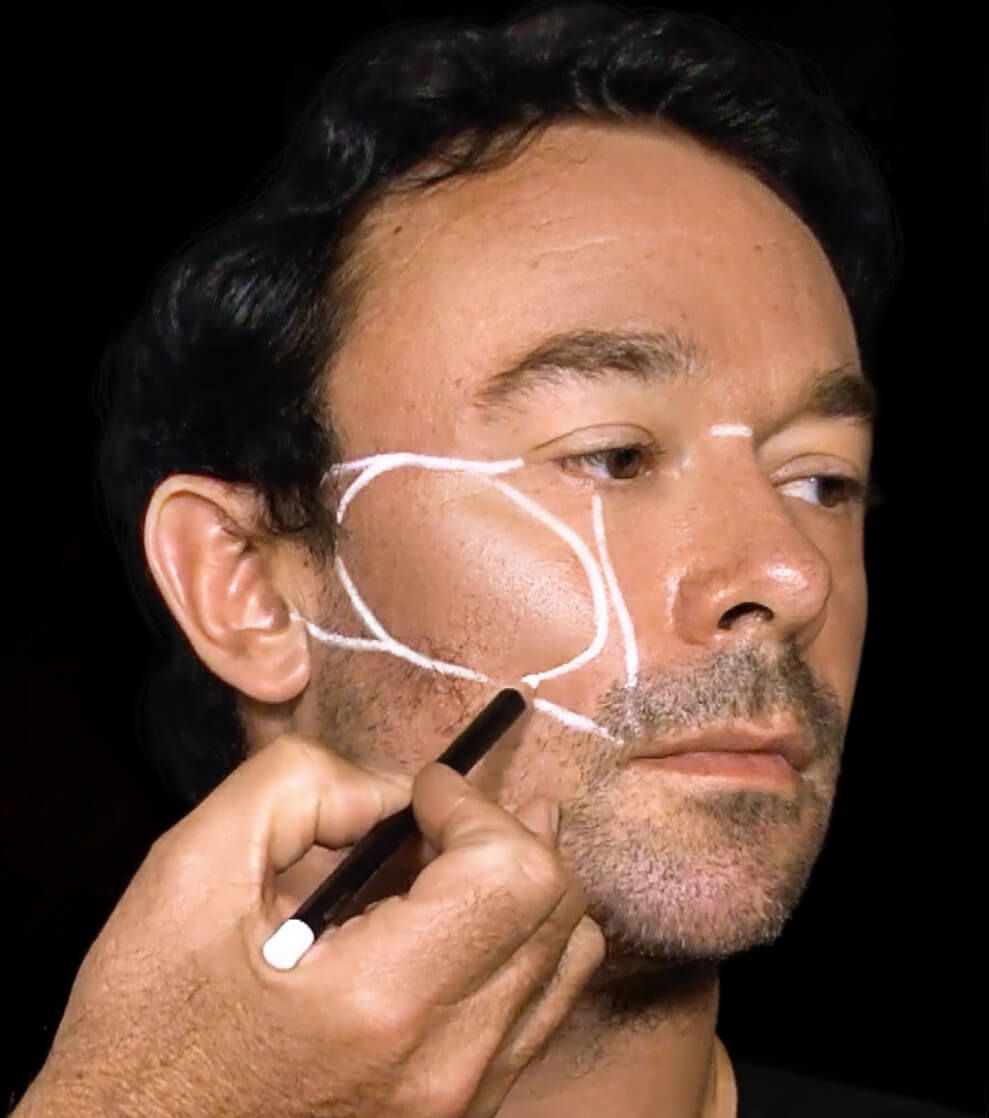 Male patient receiving caliper facial balancing consultation at Boston Beautox