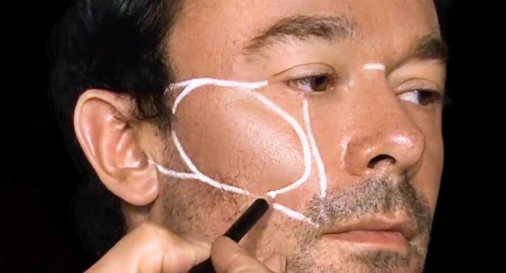 Facial mapping at Boston Beautox