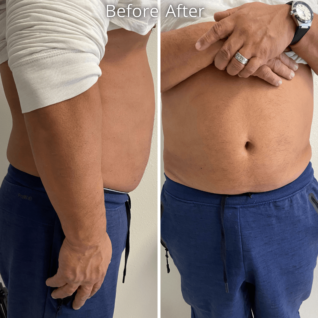 A before and after photo of a man 's stomach