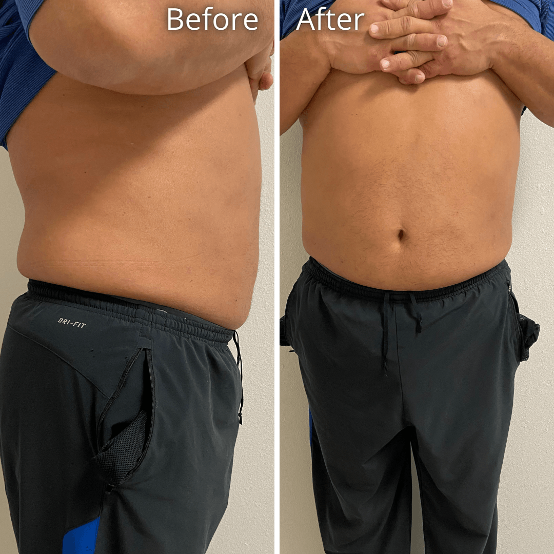 A before and after picture of a man 's stomach