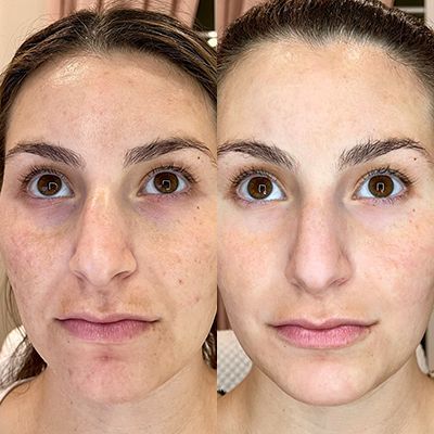 A before and after photo of a woman 's face with and without makeup.