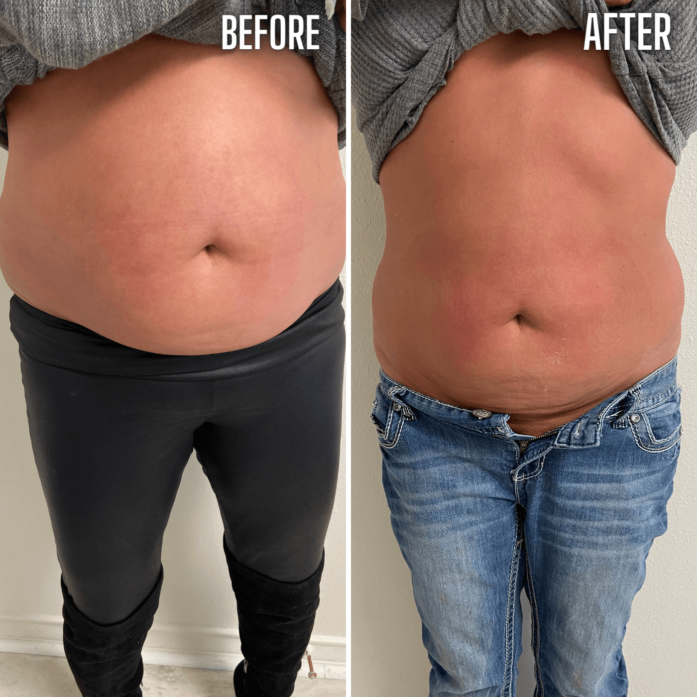 A before and after picture of a woman 's stomach.