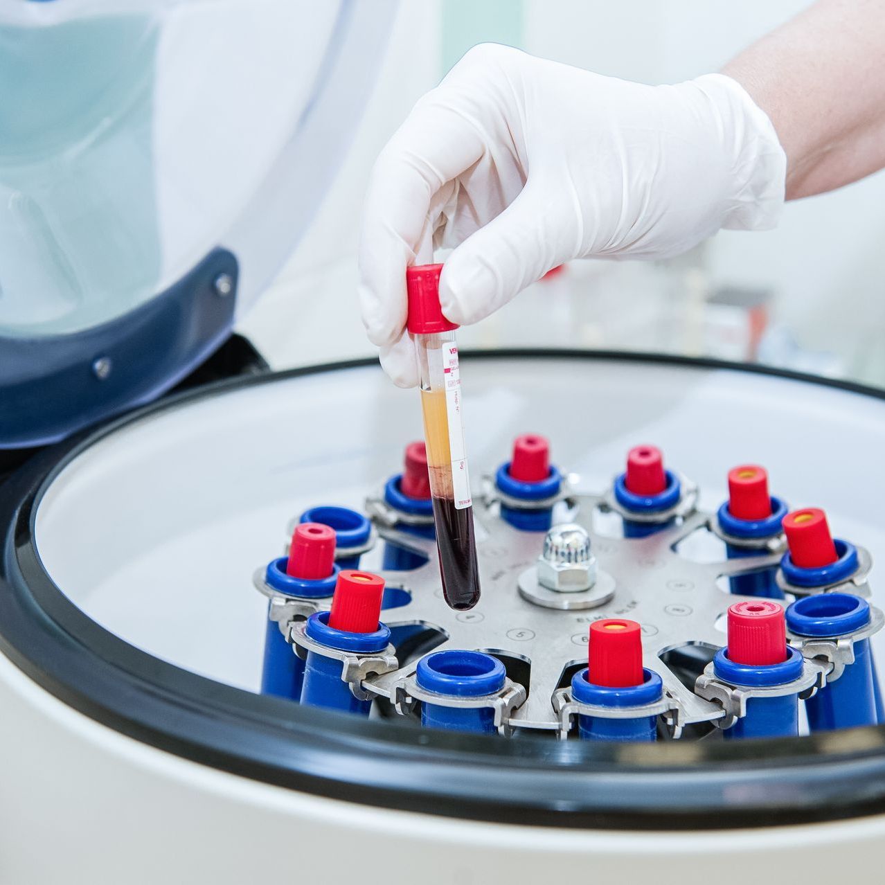 Doctor hand in medical glove with clinical chemistry samples putting them to centrifuge.