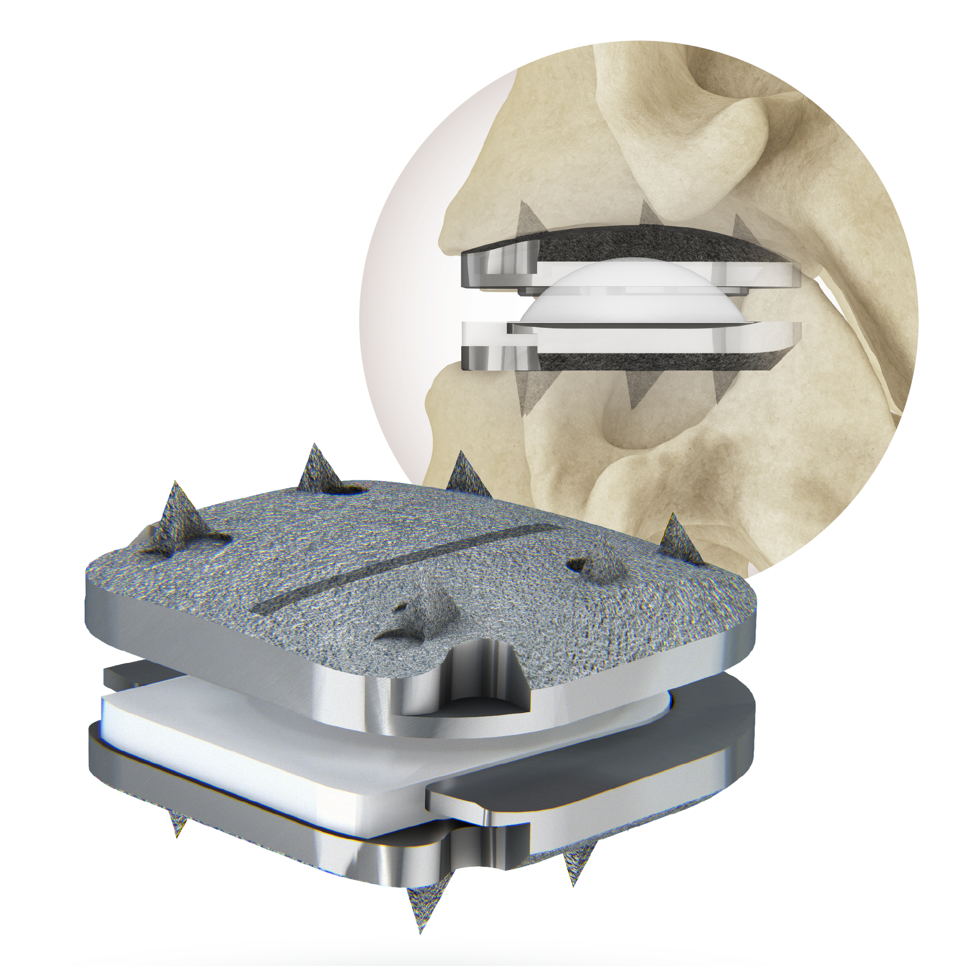 A surgical device is shown with a picture of a skeleton in the background.