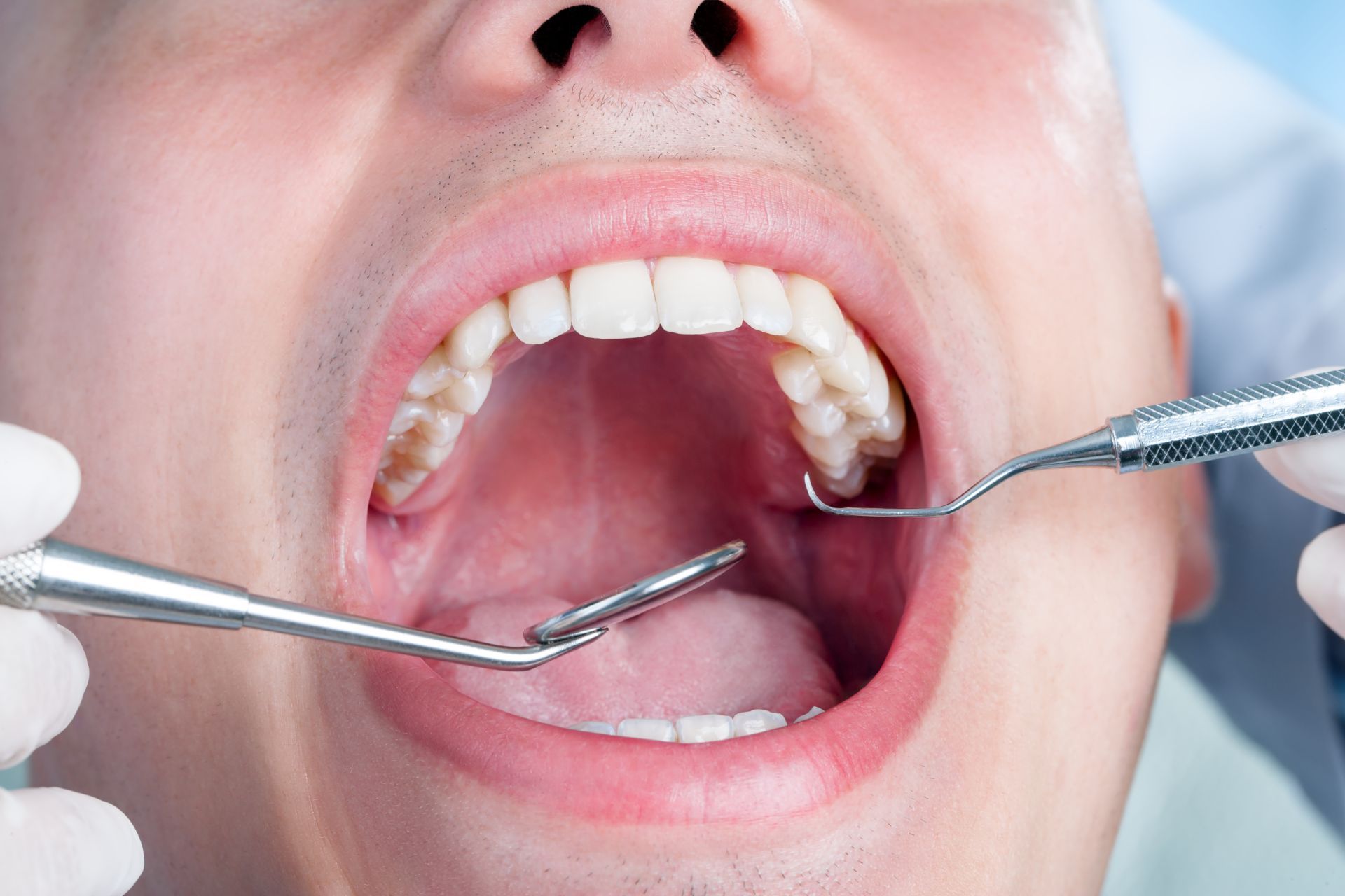 Controllo dentale