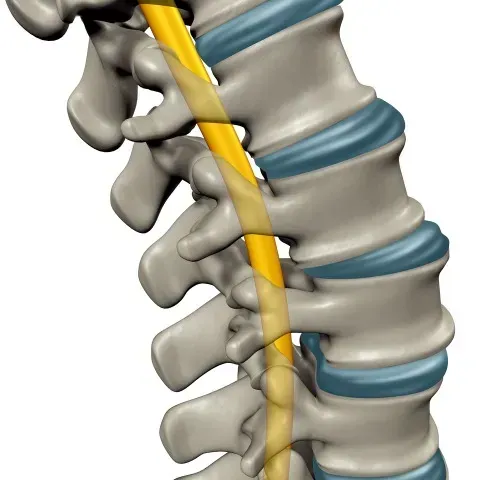 A Spine With a Yellow Nerve — Mark O'Brien Chiropractic in West End, QLD