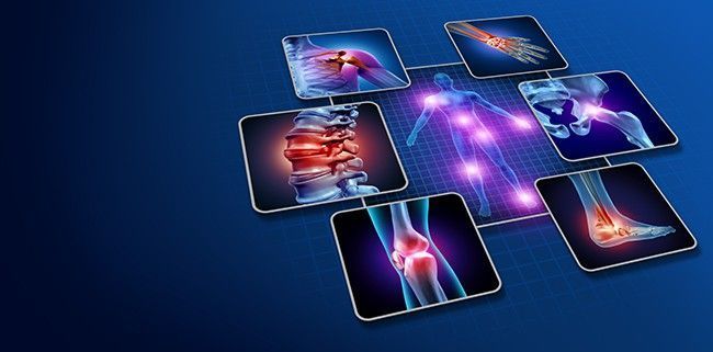 A Collage of Images of Different Types of Joint Pain — Mark O'Brien Chiropractic in West End, QLD