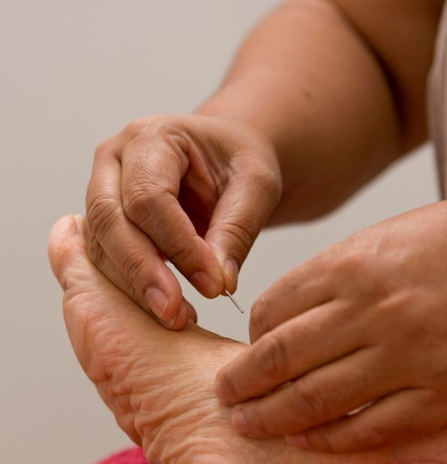 Acupuncture back treatment | Kiralee, QLD | Master Therapies