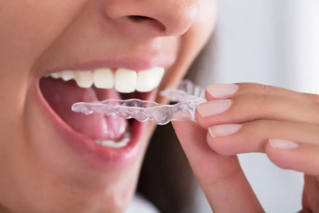 Teeth Grinding Treamtent (TMJ) in Benton AR