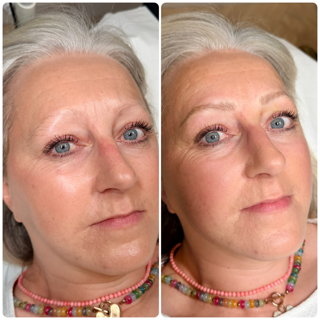Side-by-side close-up portraits of the same woman, showing a neutral face and then a slight smile.