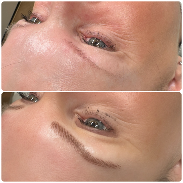 Before-and-after comparison showing the cosmetic microblading application of a new eyebrow on a person's face.