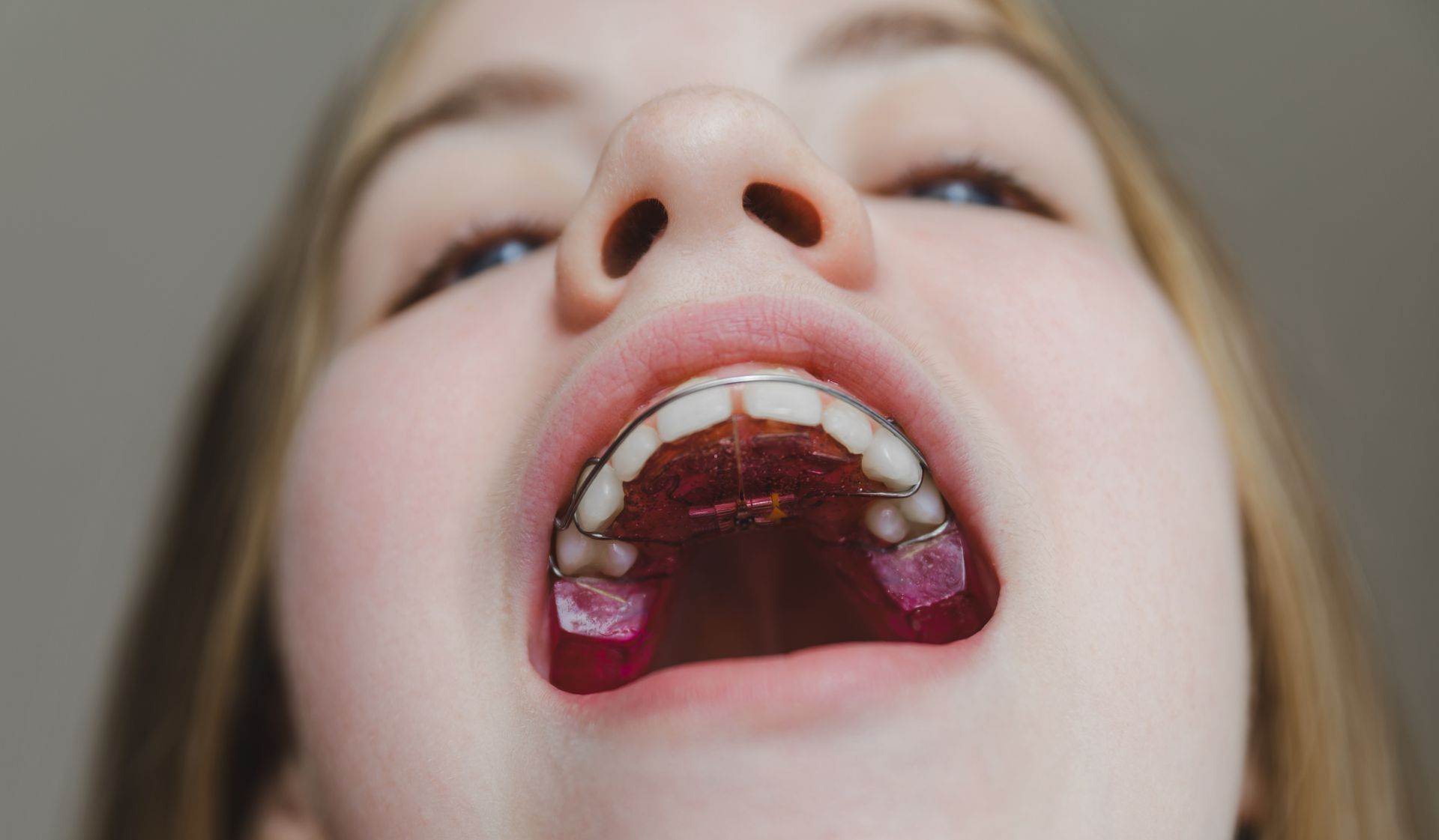 Close-up of a person with mouth open, showing teeth and throat against a plain background